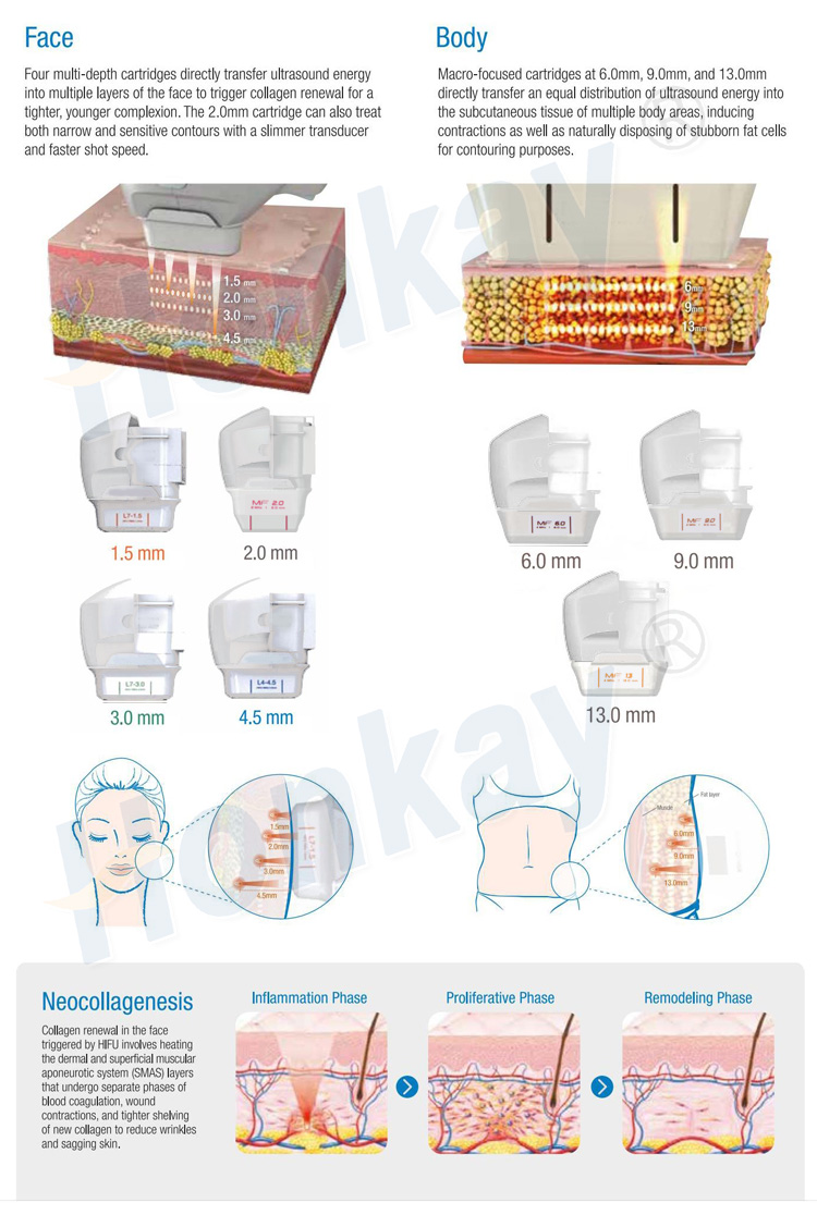 Face and body cartridges from 1.5mm to 13.0mm and the three phases of neocollagenesis