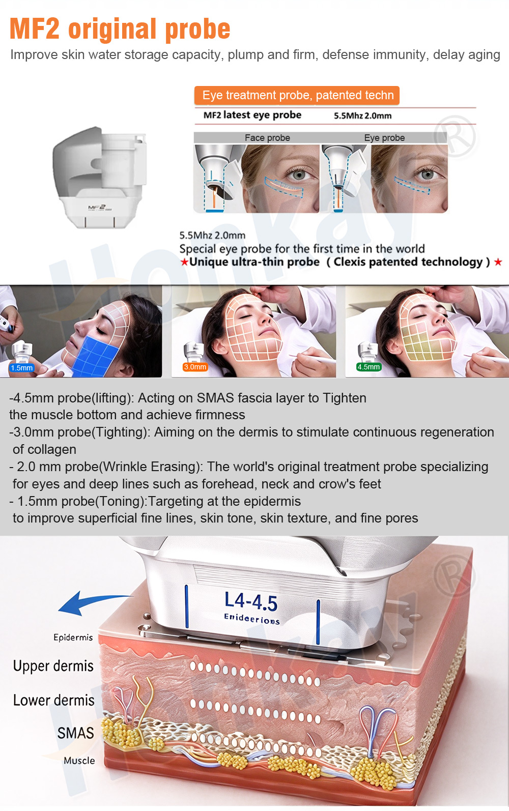 MF2 eye probe 5.5MHz 2.0mm and the four facial working depths