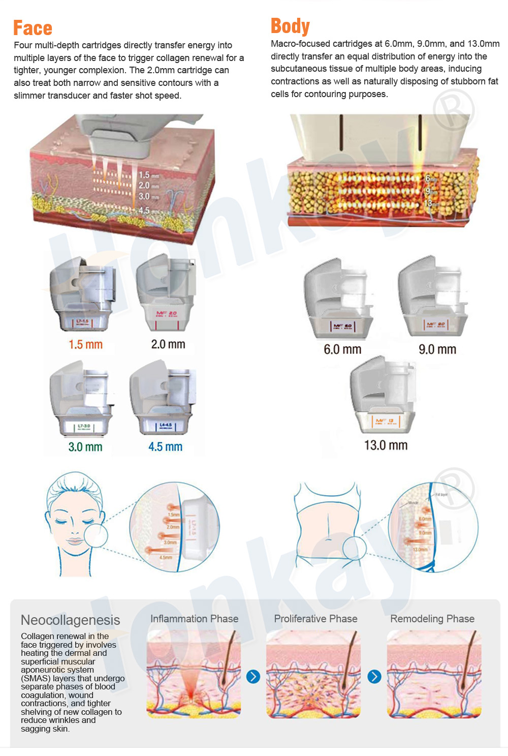 Face and body cartridge depths from 1.5mm to 13.0mm and the three phases of neocollagenesis