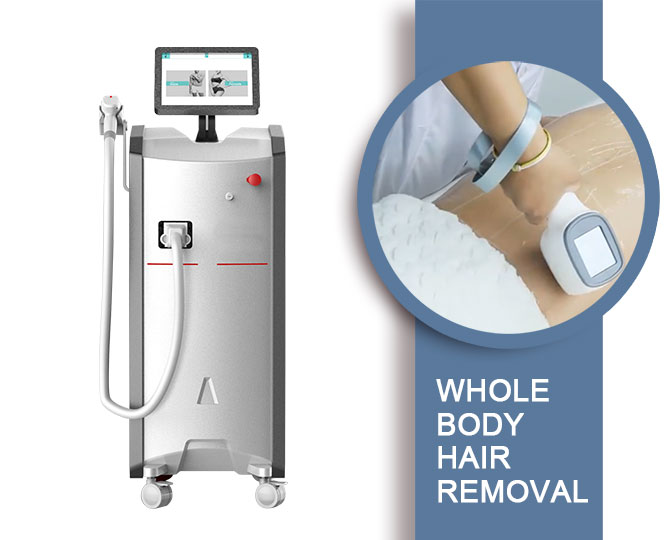 808 nm laser hair removal