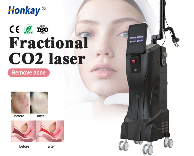 best fractional co2 laser machine