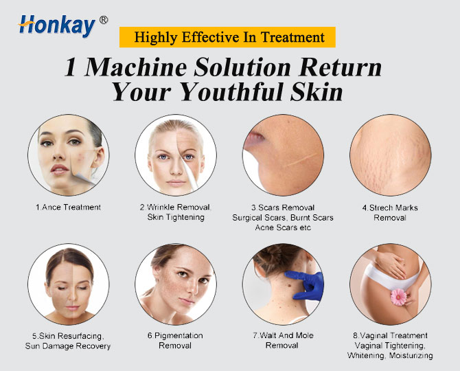 fractional co2 laser resurfacing machine