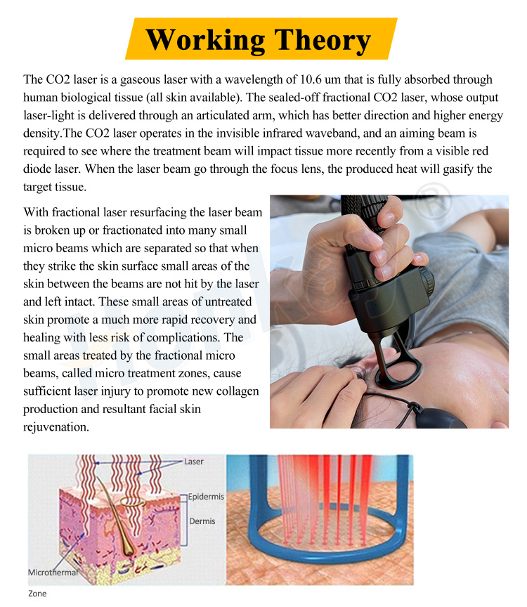 portable co2 fractional laser machine