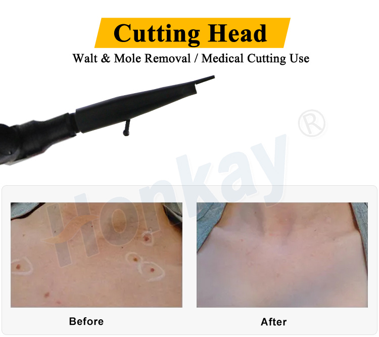 portable co2 fractional laser machine