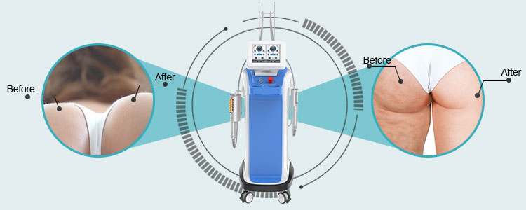 Roller mssage machine