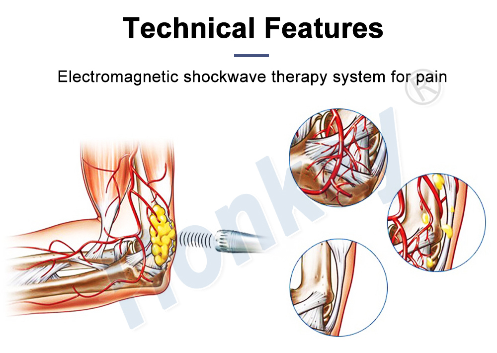 shockwave therapy machine