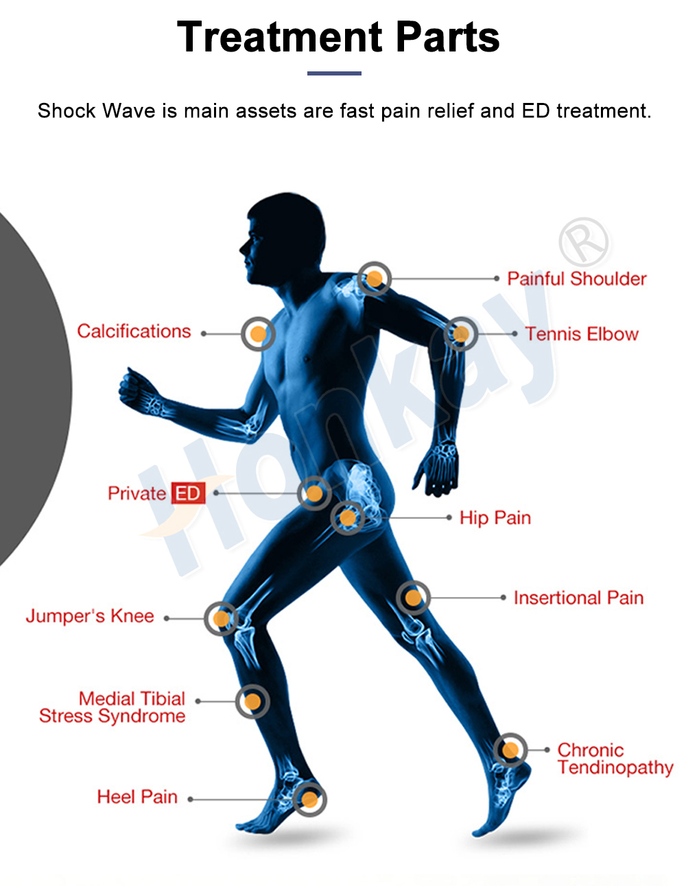 shockwave therapy machine