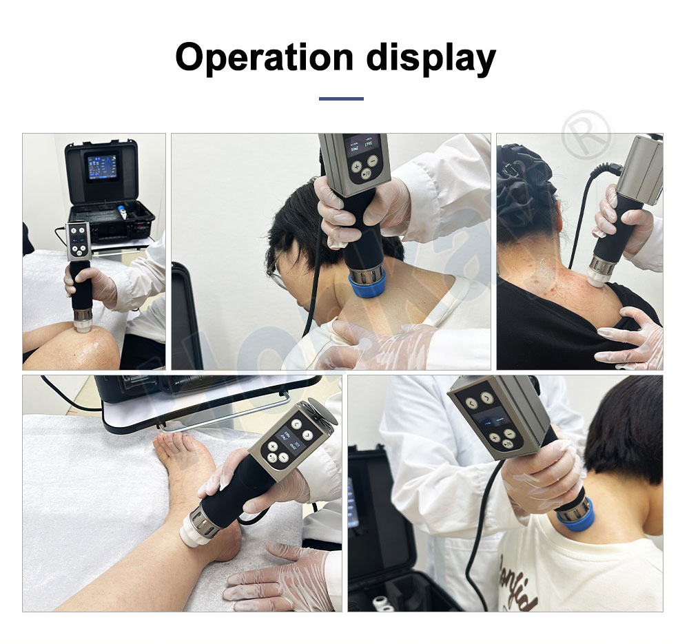 Shockwave Treatment Benefits