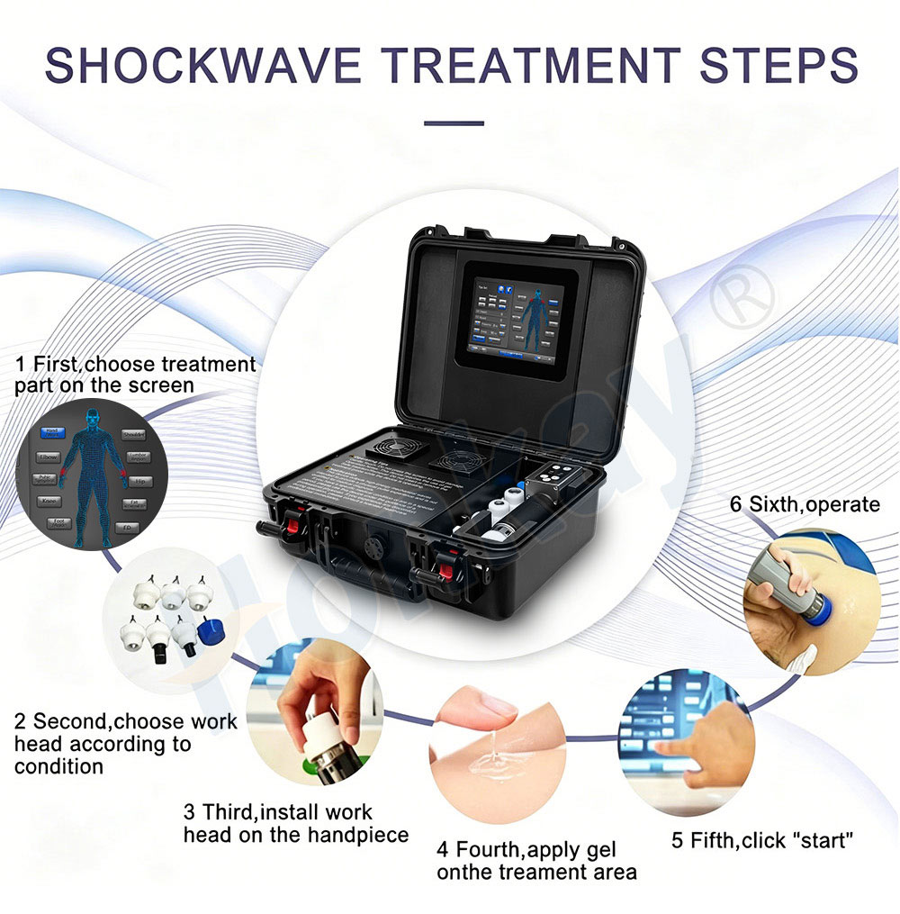 Shockwave Handle