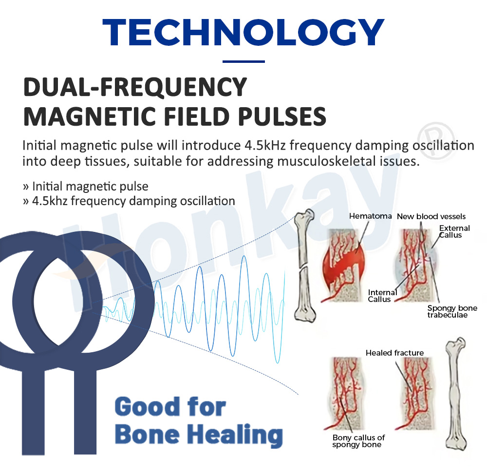 Dual-frequency magnetic field pulses - 4.5 kHz damping oscillation for bone healing