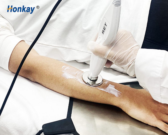 portable 448khz tecar machine