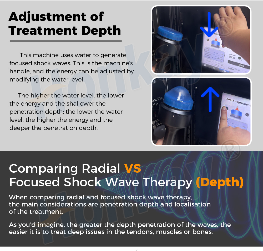 portable focus shockwave machine