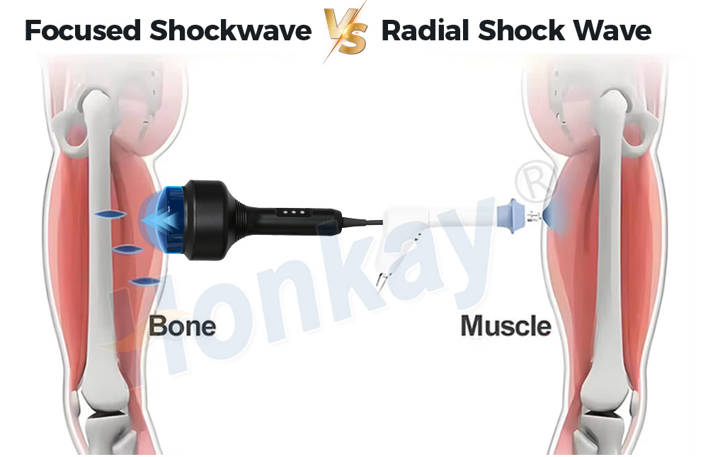 portable focus shockwave machine