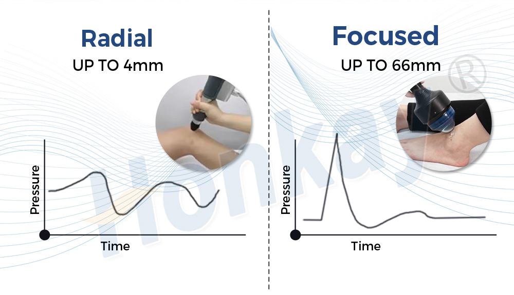 portable focus shockwave machine