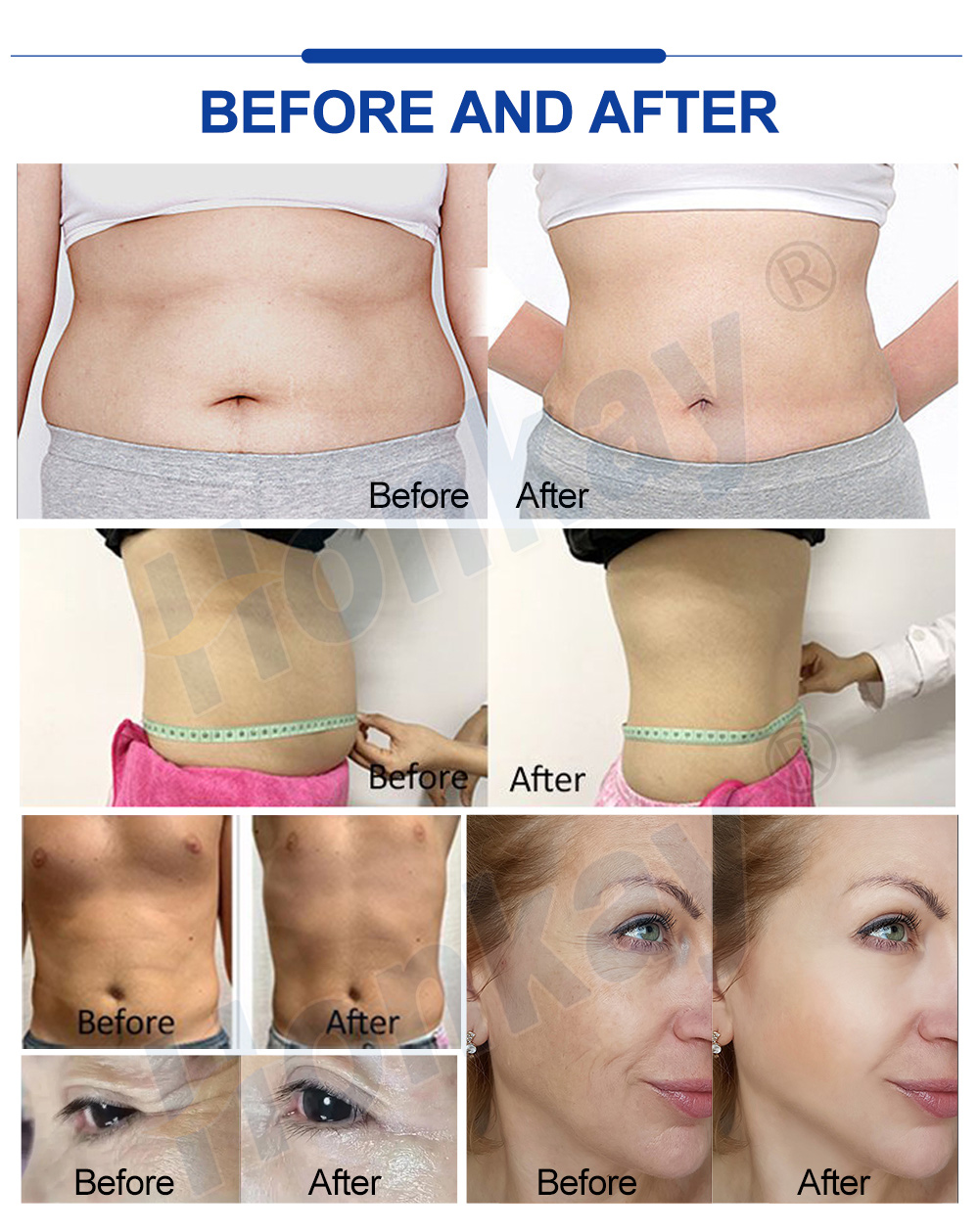 Manufacturer supplied before and after images
