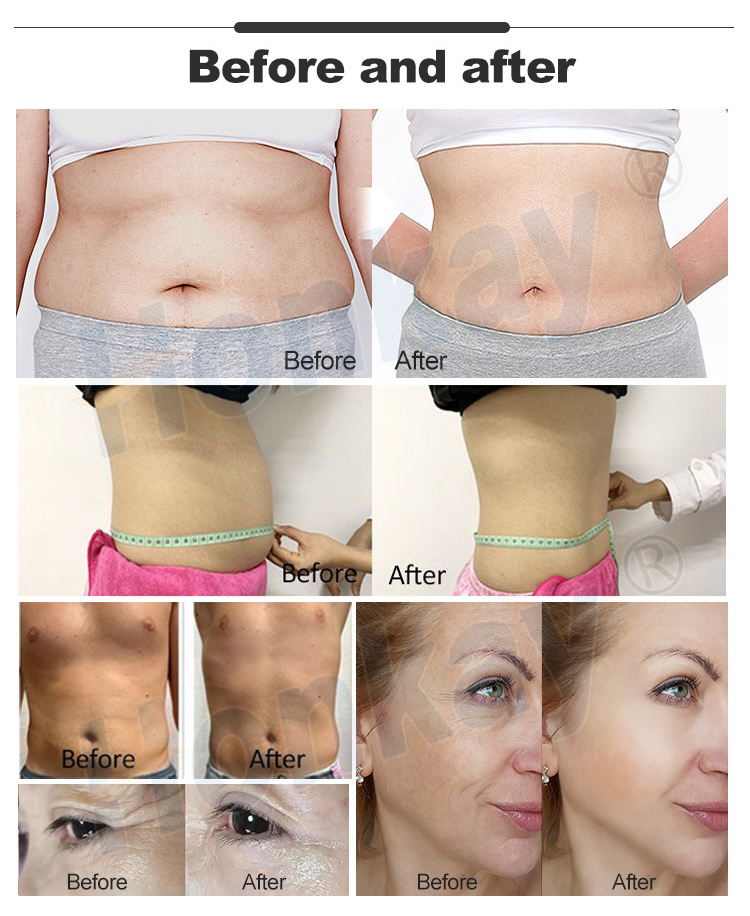 tecar therapy machine cost