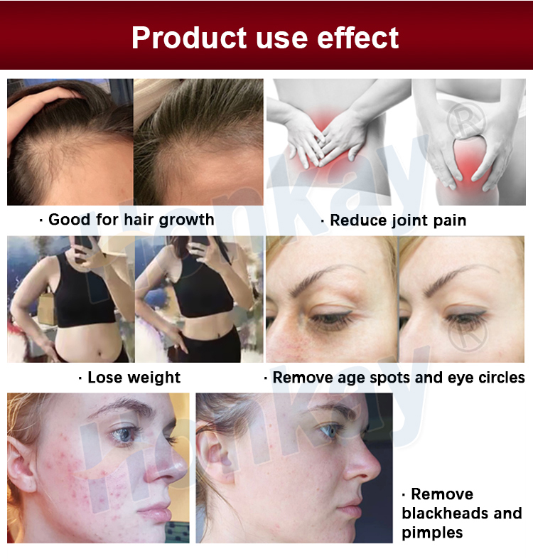 red light therapy device for pain relief
