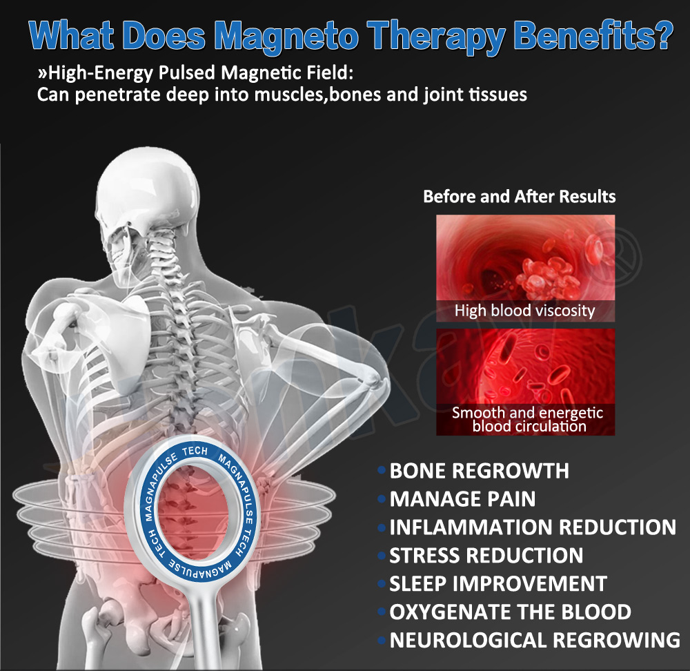 Physio Magneto Therapy Machine