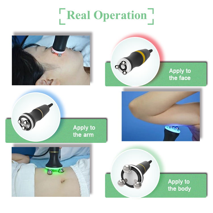 rf skin lifting device reviews