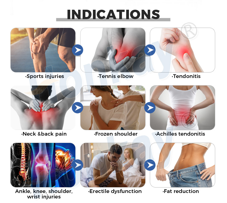 electromagnetic extracorporeal shock wave therapy machine