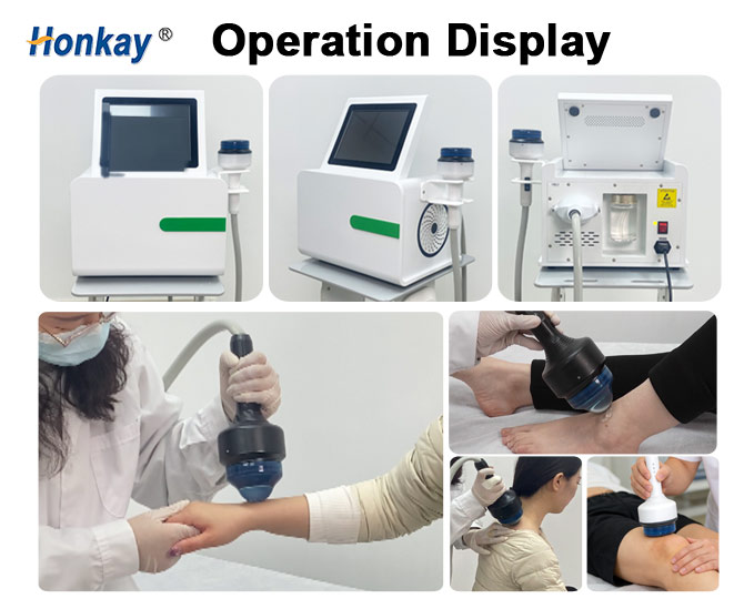 focused shockwave therapy machine for sale