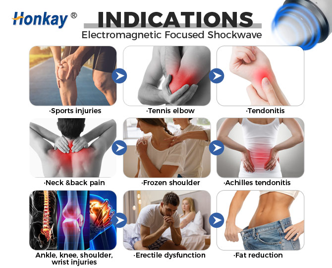 focused shockwave therapy machine for home use