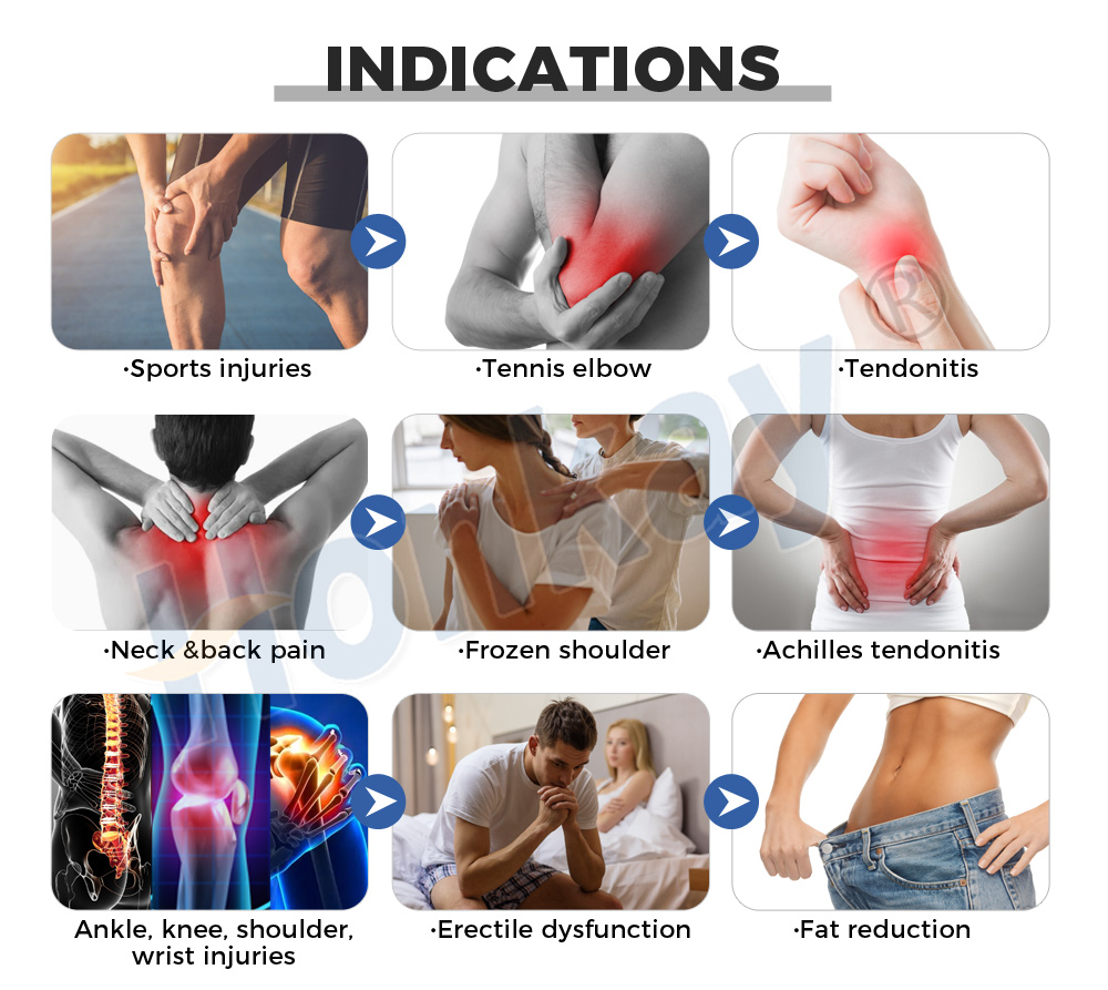 shockwave therapy machine benefit
