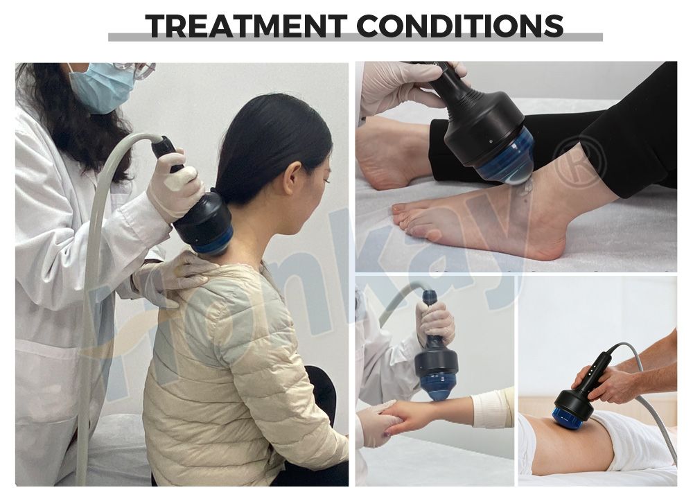 shockwave therapy machine benefit