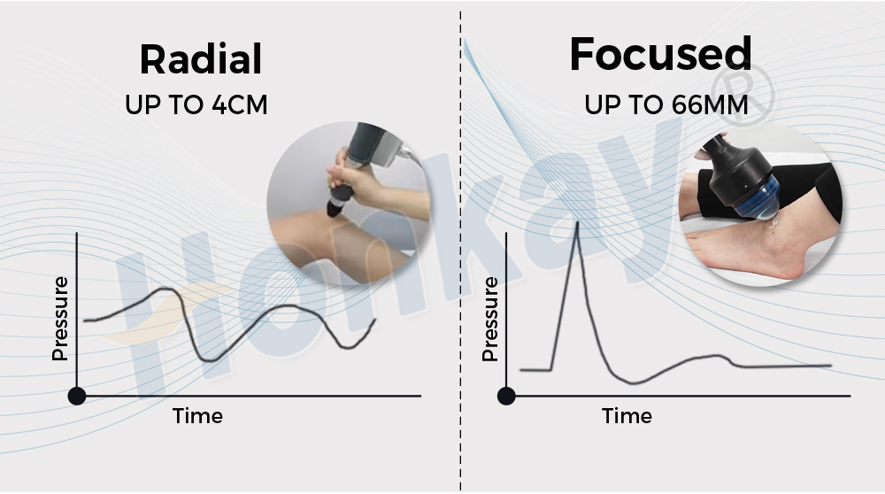 shockwave therapy machine benefit
