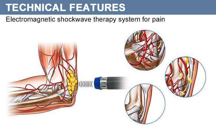 portable shockwave therapy machine for sale