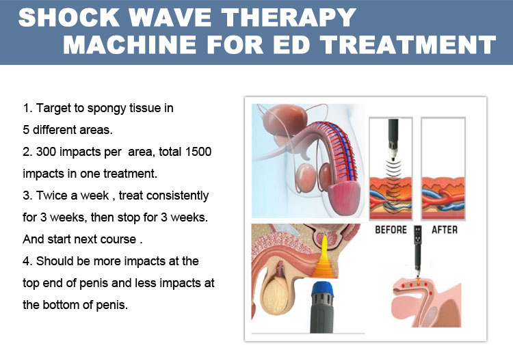 shockwave therapy machine for ed treatment