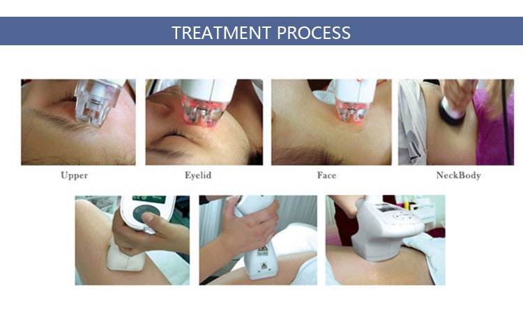 cellulite machine treatment 5