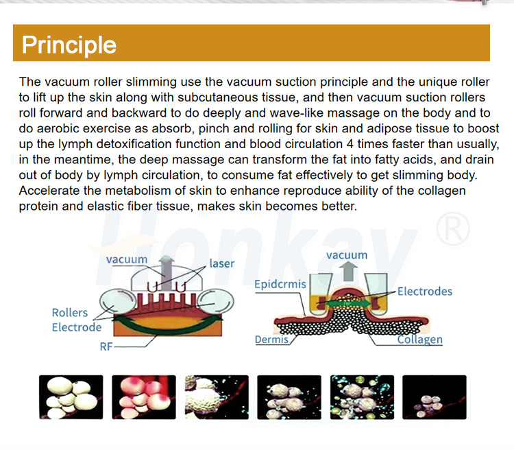 velashape 3 machine