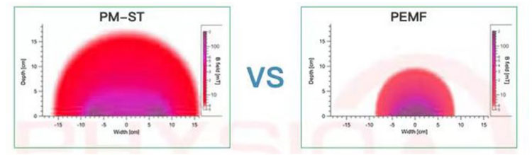 PMST-VS-PEMF