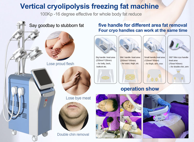 cryolipolysis body slimming machine