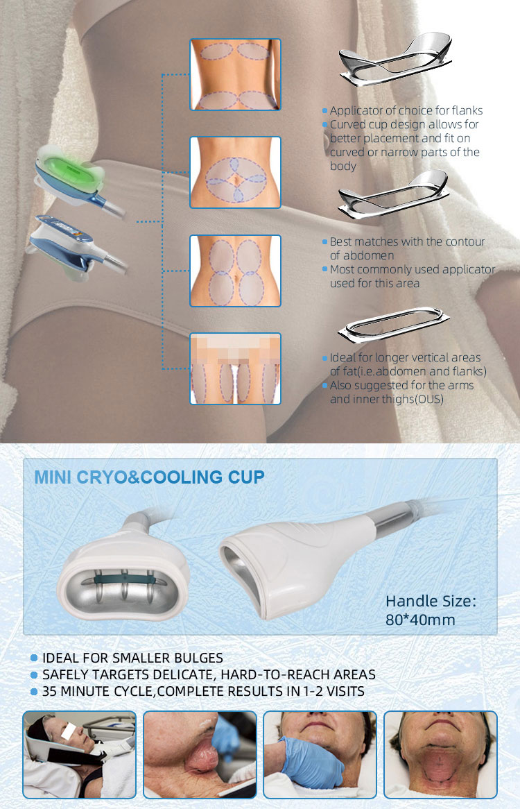 cryolipolysis machine for sale