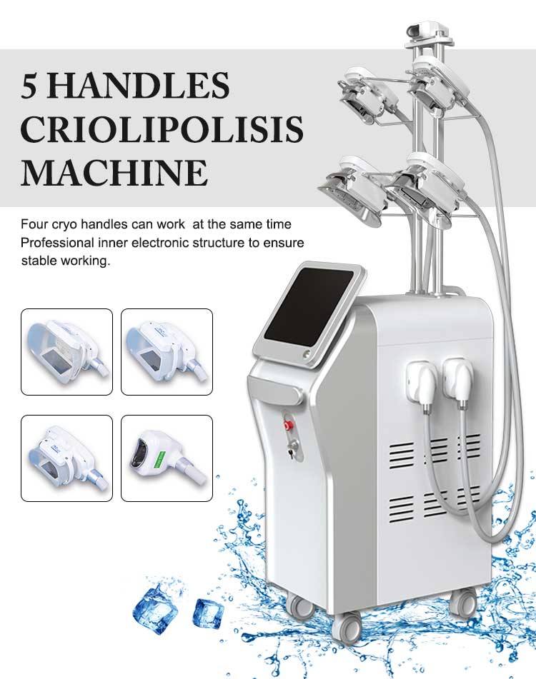 cryolipolysis machine show
