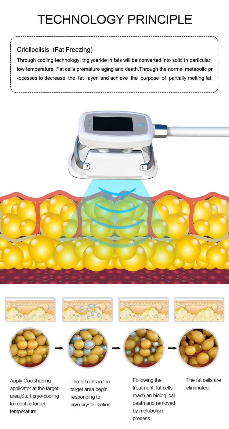 cryolipolysis machine