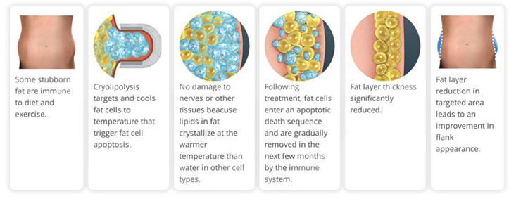 how does cryolipolysis work