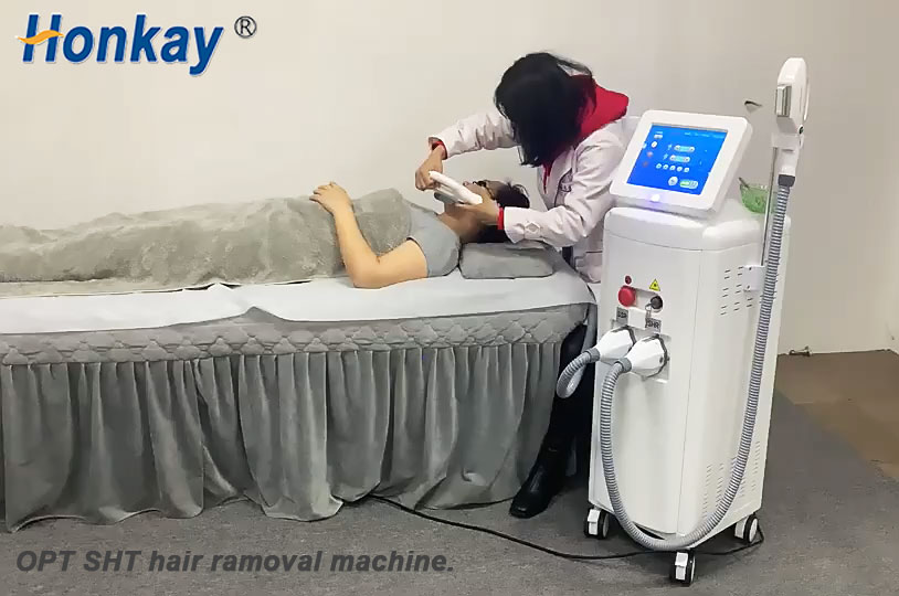 opt hair removal machine