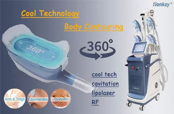 cryolipolysis
