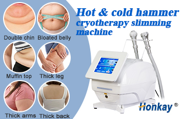 fat freezing machine price