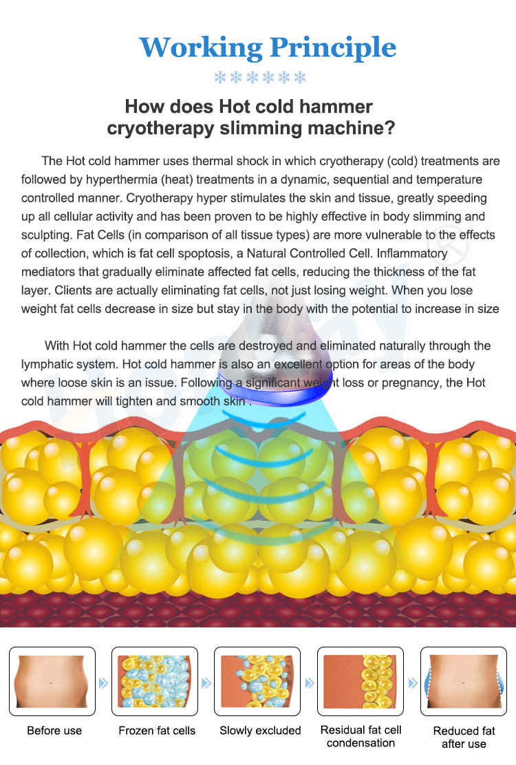 cry tech fat freezing machine-2