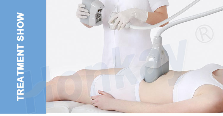 cryolipolysis machine cost