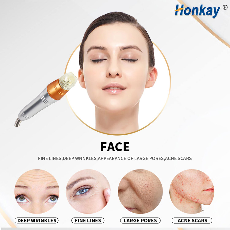 fractional rf microneedling machine