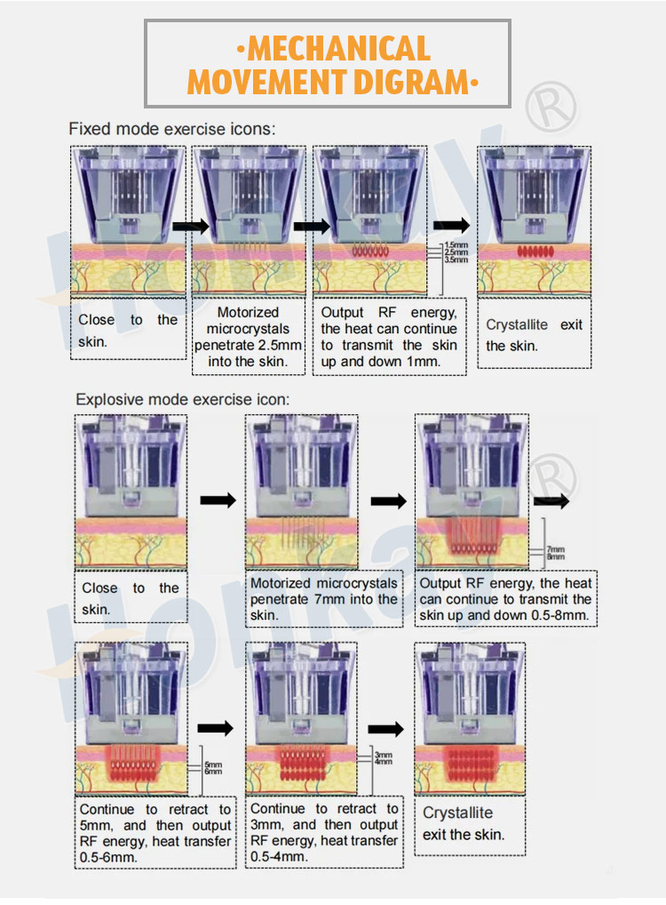 microneedle radiofrequency device 3