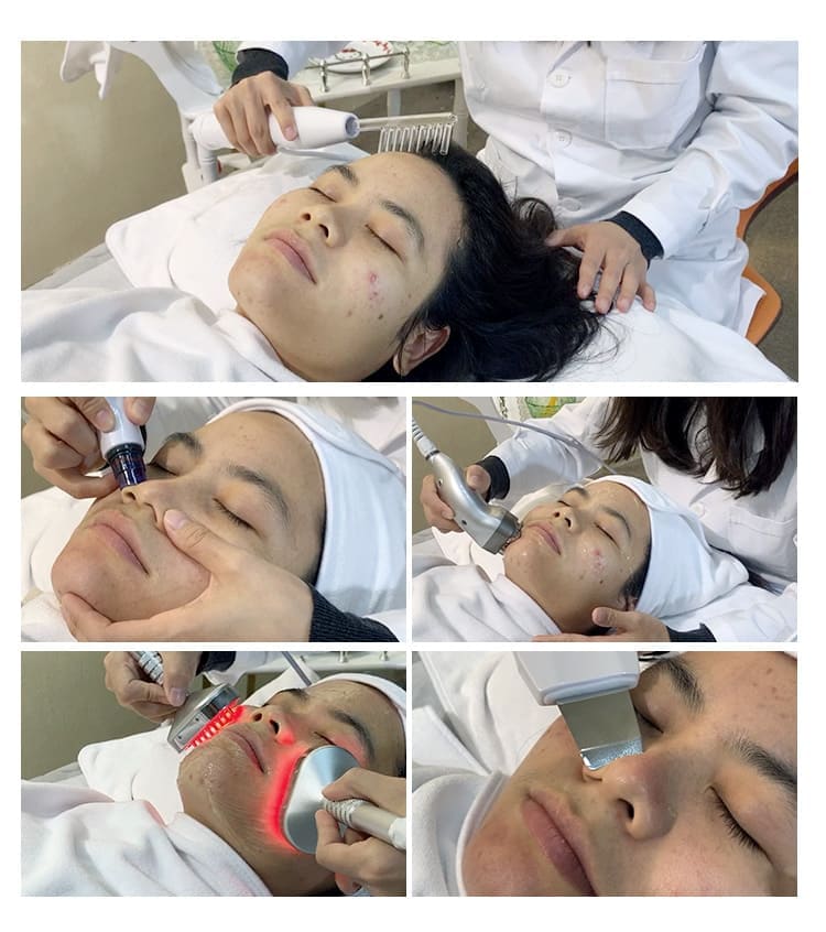 8 in 1 hydra dermabrasion facial machine