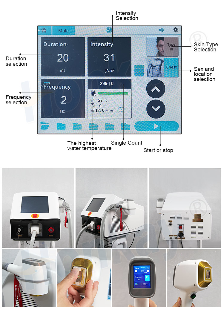 808nm diode laser hair removal machine price