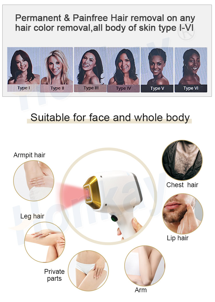 808nm diode laser hair removal machine