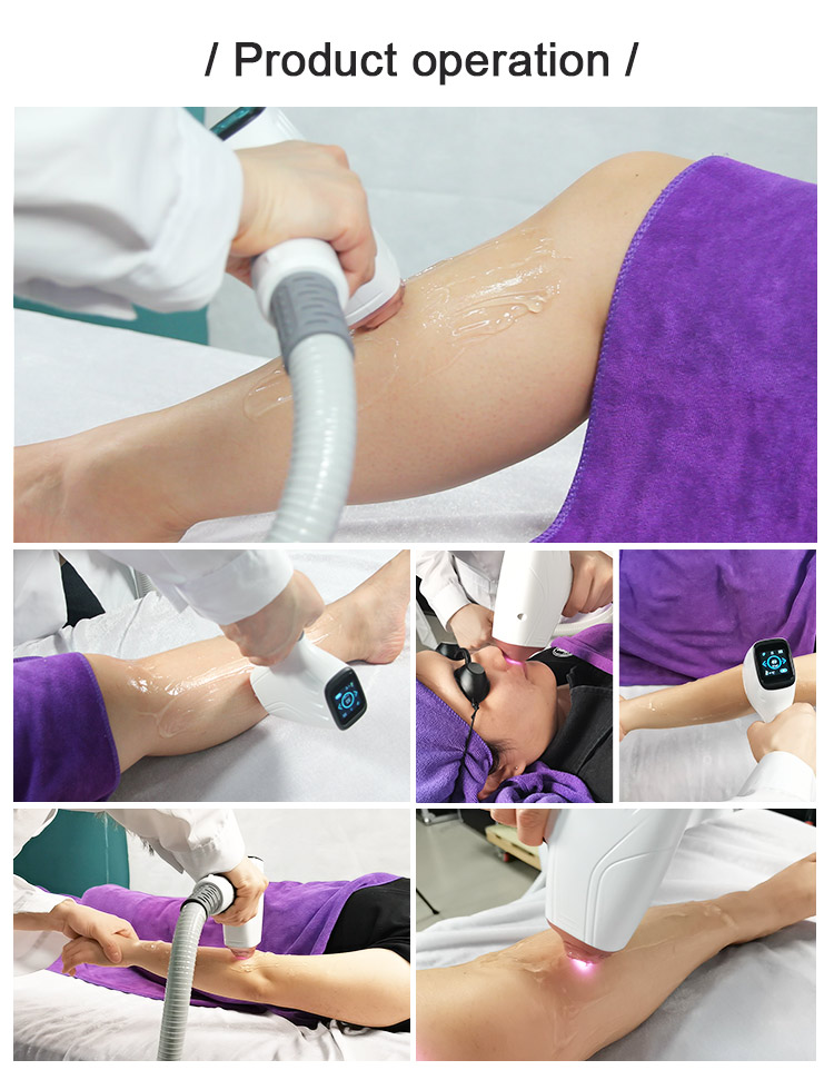 laser hair removal device manufacturer